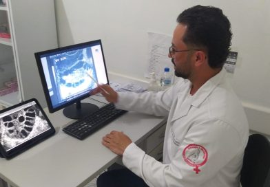 Centro da Mulher: Ginecologista alerta para sintomas e diagnóstico da Síndrome dos Ovários Policísticos Centro da Mulher: Ginecologista alerta para sintomas e diagnóstico da Síndrome dos Ovários Policísticos
